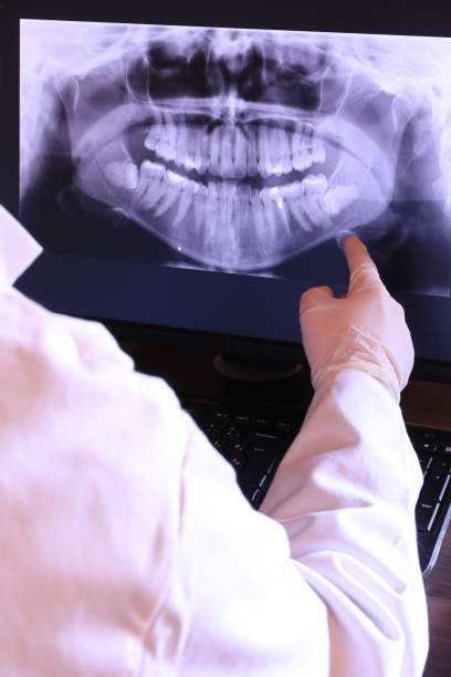 Best Emergency Dental Care for Broken or Chipped Teeth in South Sarasota, FL
